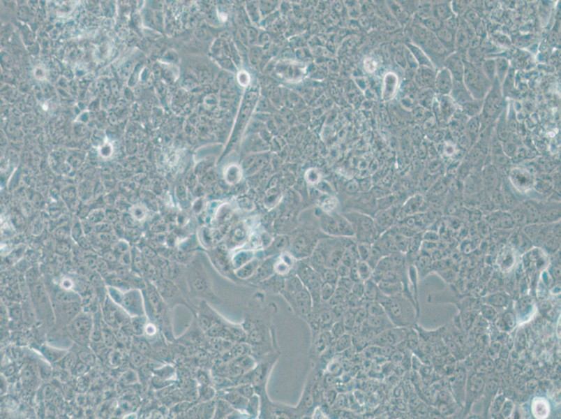 NCI-H1793 Cell Complete Medium - small - 5