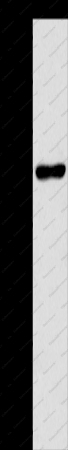 CD218b Polyclonal Antibody - 1