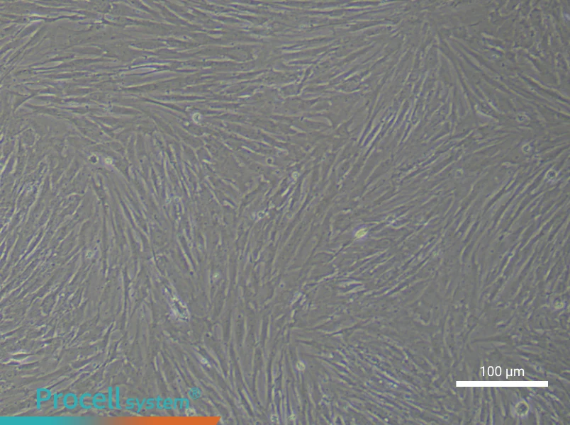 Human Synovial Cell Complete Medium - 1