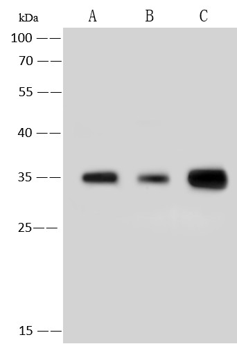 Recombinant PCNA Monoclonal Antibody - small - 5