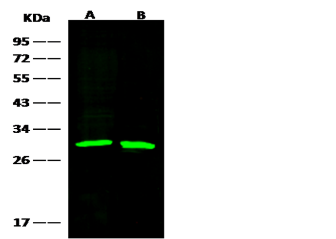 Recombinant GSTM2 Monoclonal Antibody