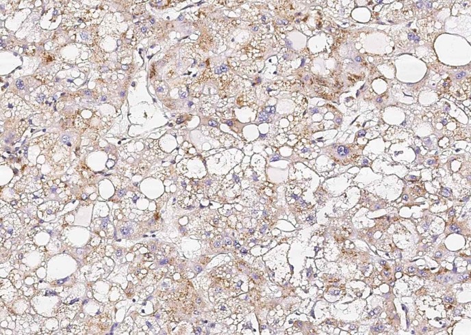Recombinant Osteopontin/SPP1/ETA-1 Monoclonal Antibody - small - 3