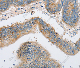 ARHGEF9 Polyclonal Antibody - 3