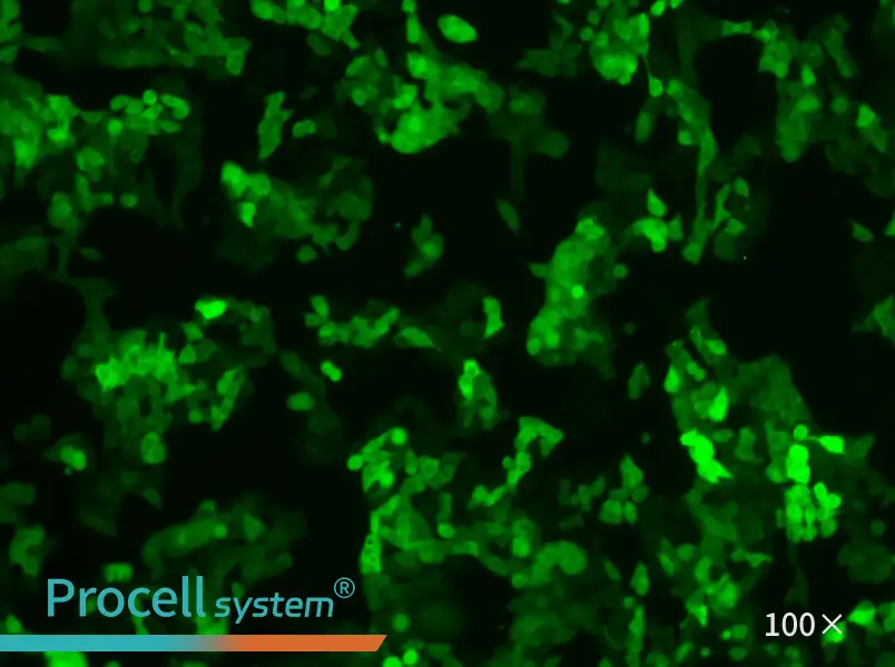 SW620-GFP Cell Complete MediumSW620-GFP Cell Complete Medium - 2