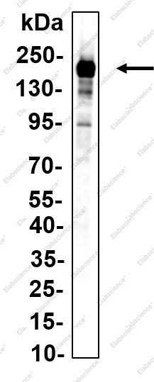 Recombinant KDM6A/UTX Monoclonal Antibody - 1