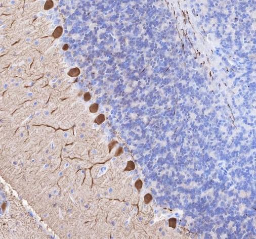 Recombinant Calbindin Monoclonal Antibody - small - 4