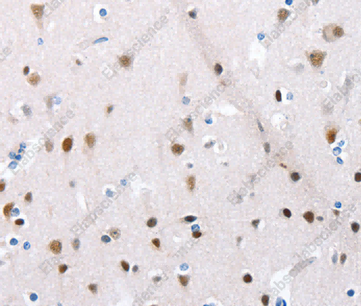 POMC Polyclonal Antibody - 2