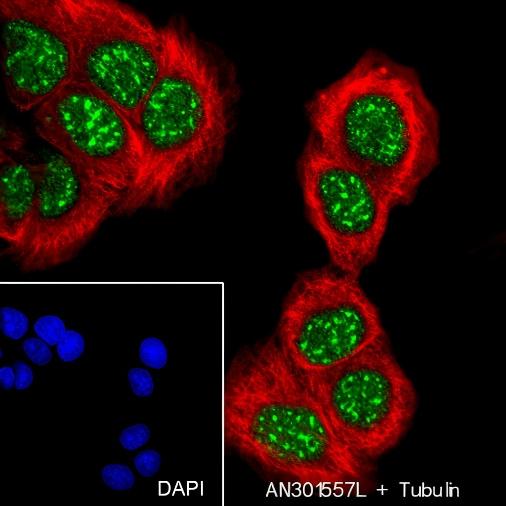 Recombinant SETD1A Monoclonal Antibody - small - 5