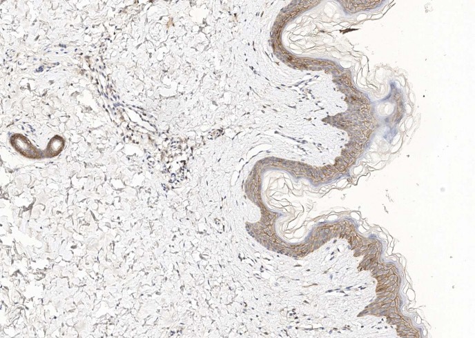 TROP2/TACSTD2 Monoclonal Antibody - small - 7