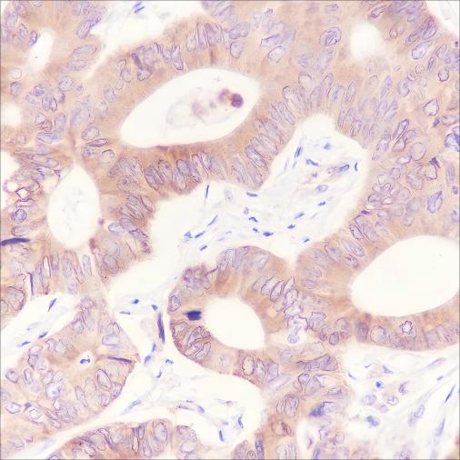 Recombinant ATG4B Monoclonal Antibody - 2