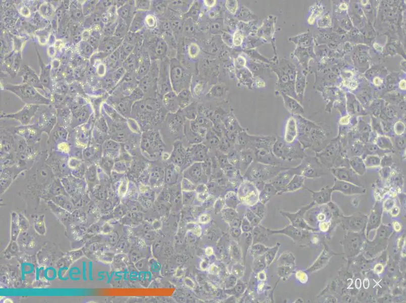 NCI-H1915 Cell Complete Medium - 5