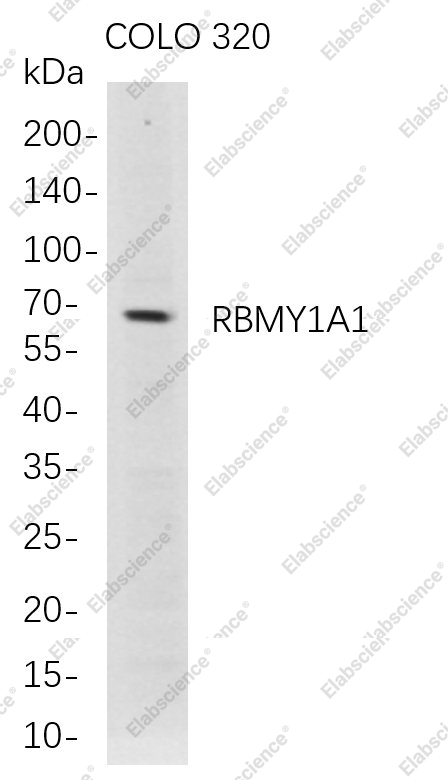 Recombinant RBMY1A1 Monoclonal Antibody - 1