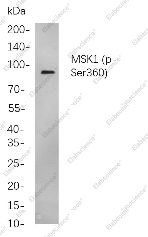 Recombinant Phospho-MSK1 (Ser360) Monoclonal Antibody - 1