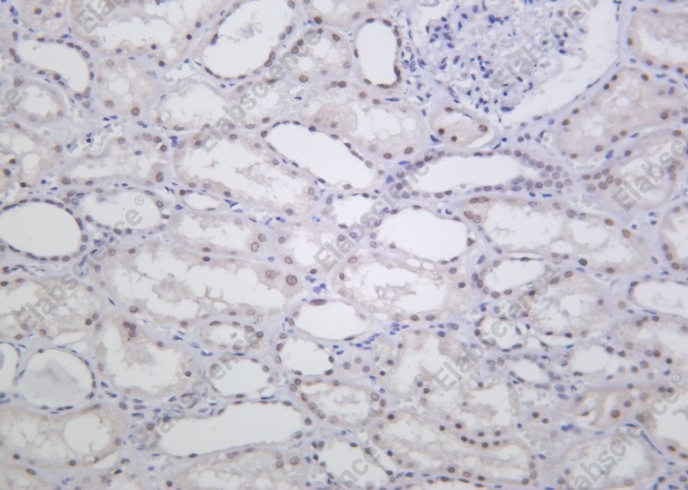 Recombinant ALKBH5 Monoclonal Antibody - 1