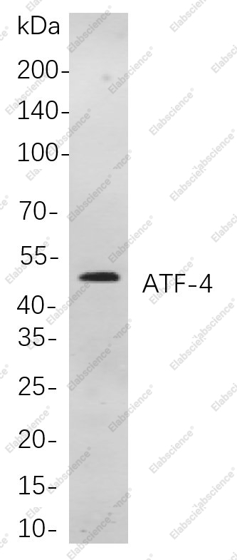 Recombinant ATF-4 Monoclonal Antibody - 1