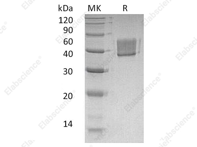 Recombinant Human FCRL1 Protein (His Tag) - 1