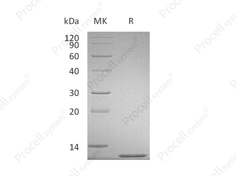 MCP-1/CCL2, Mouse, Recombinant