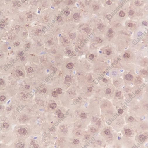 Recombinant SETBP1 Monoclonal Antibody - 4