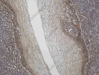 Recombinant Presenilin 1 Monoclonal Antibody - 2