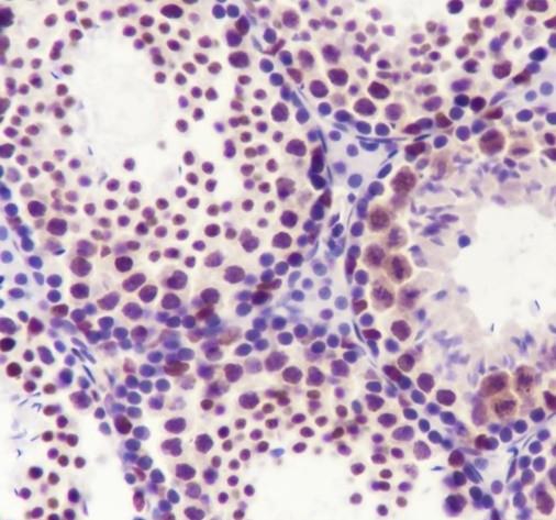 Recombinant SMARCA2/BRM Monoclonal Antibody - small - 4