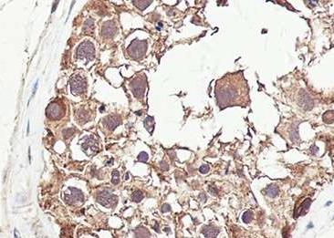 Recombinant EID1 Monoclonal Antibody-searchlist-2