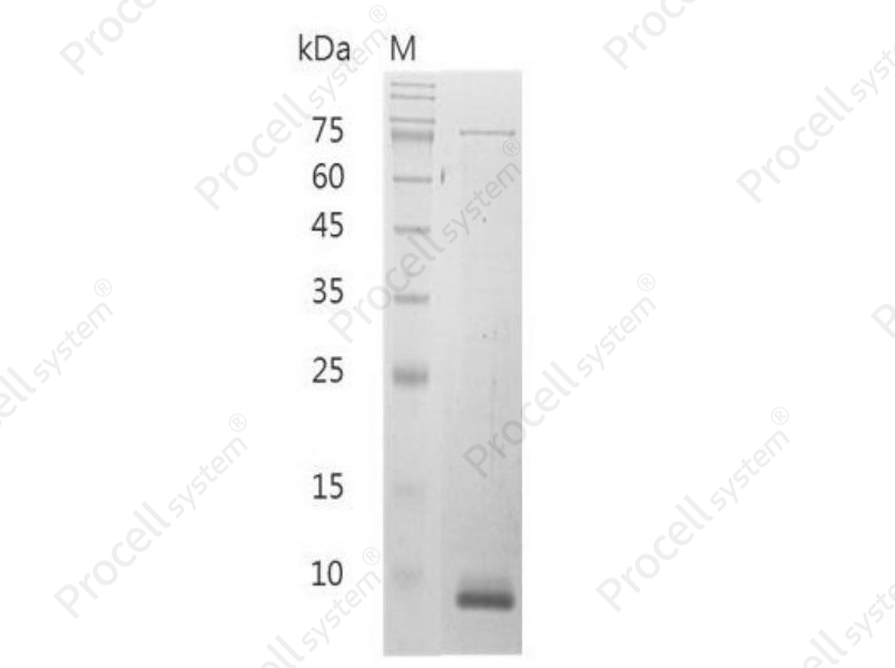 CXCL11/I-TAC/B-R1, Mouse, Recombinant