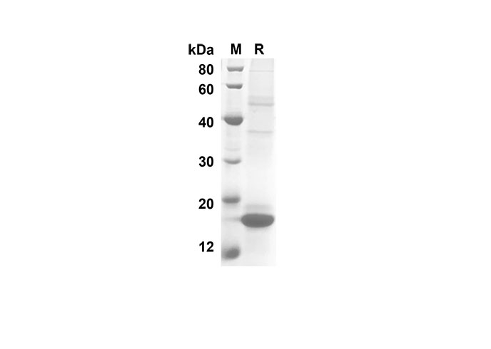 Recombinant Human IL10 Protein(His Tag)-1