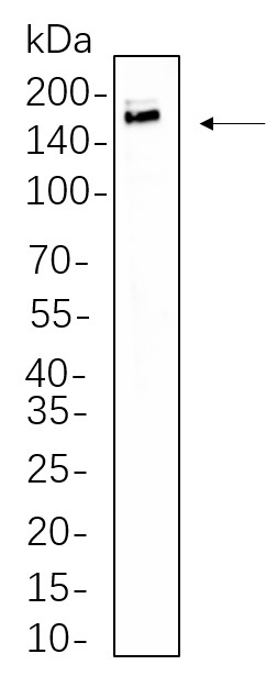 Recombinant IRS-1 Monoclonal Antibody-searchlist-1