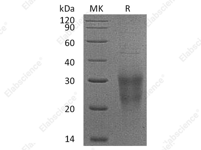 Recombinant Human NKG2D/CD314 Protein (His Tag) - 1
