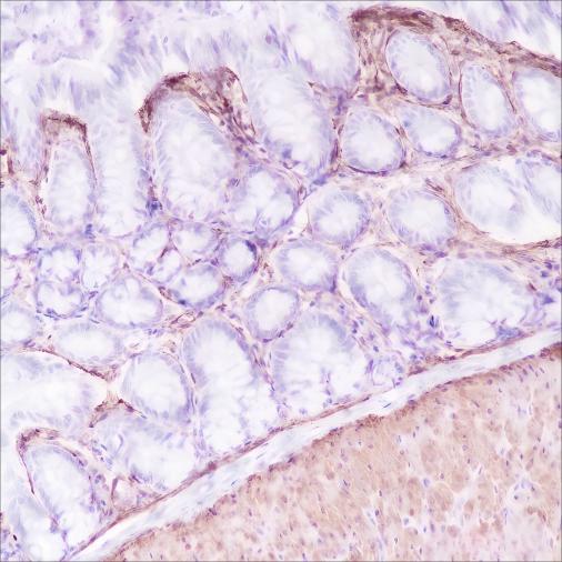 Recombinant Caldesmon/CDM Monoclonal Antibody - small - 4