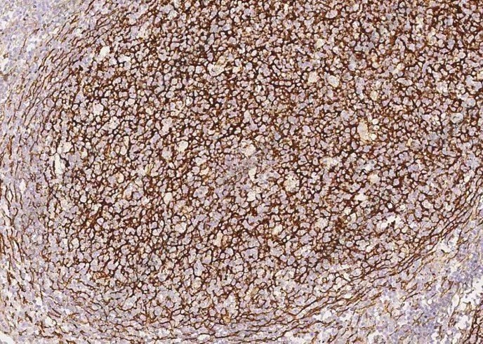 VCAM1/VCAM-1/CD106 Monoclonal Antibody - 1