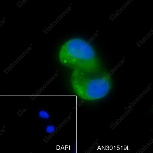Recombinant Factor XIIIa Monoclonal Antibody - 7