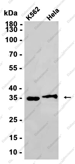 Recombinant CDK1 Monoclonal Antibody - 1