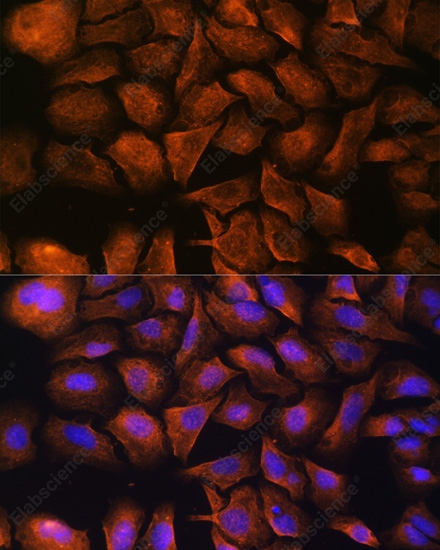 SPTAN1 Polyclonal Antibody - 6