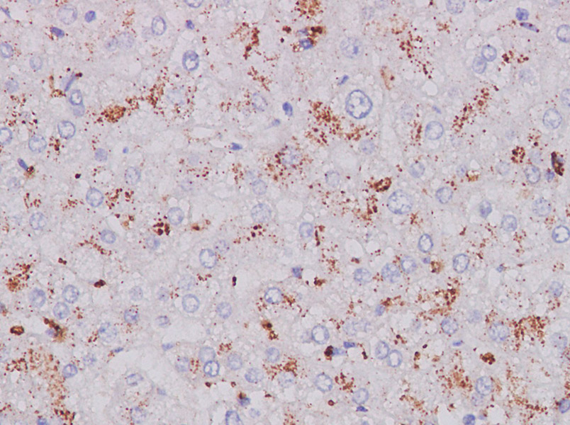 Purified Anti-Human CD123 Antibody[HI8D7]-产品推荐-1