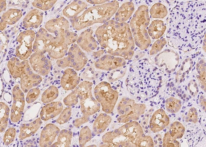 Recombinant Syndecan-1/SDC1 Monoclonal Antibody-searchlist-1