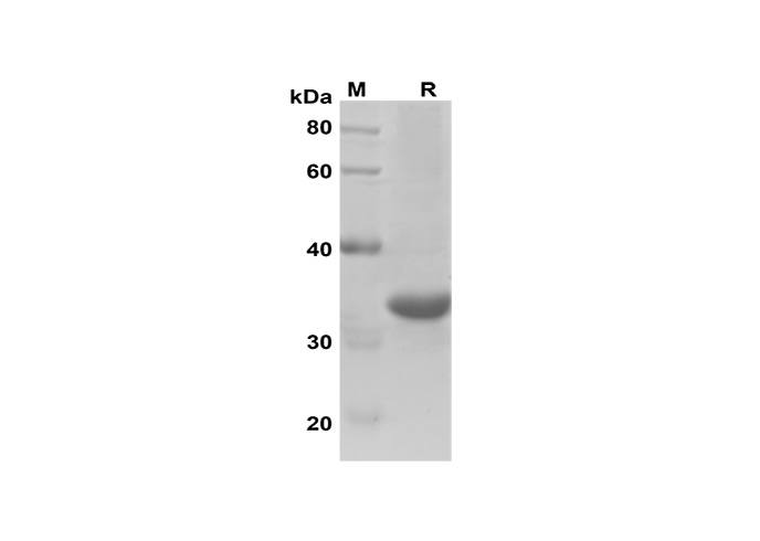 Recombinant Rat IL-17A Protein(Trx Tag)-1