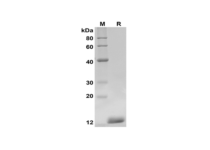 Recombinant Mouse IL-17A Protein(Sumo Tag)-产品推荐-1