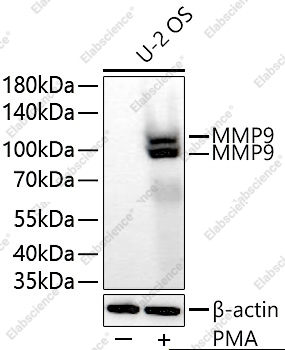 MMP9 Polyclonal Antibody - 6