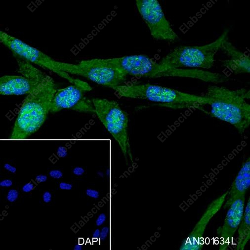 Recombinant PPP1CB Monoclonal Antibody - 4