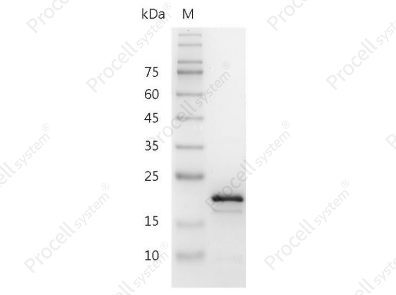 IL-11/AGIF, Mouse, Recombinant - 1