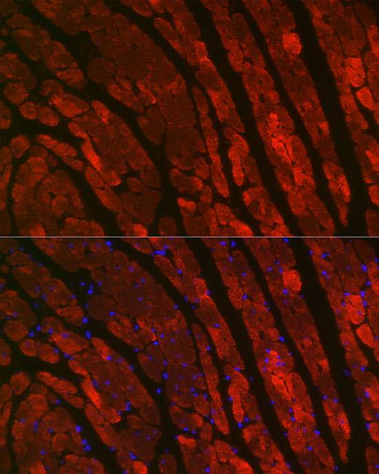 Immunofluorescence analysis of rat heart cells using TNNC1 Polyclonal Antibody at dilution of 1:100 (40x lens). Blue: DAPI for nuclear staining.