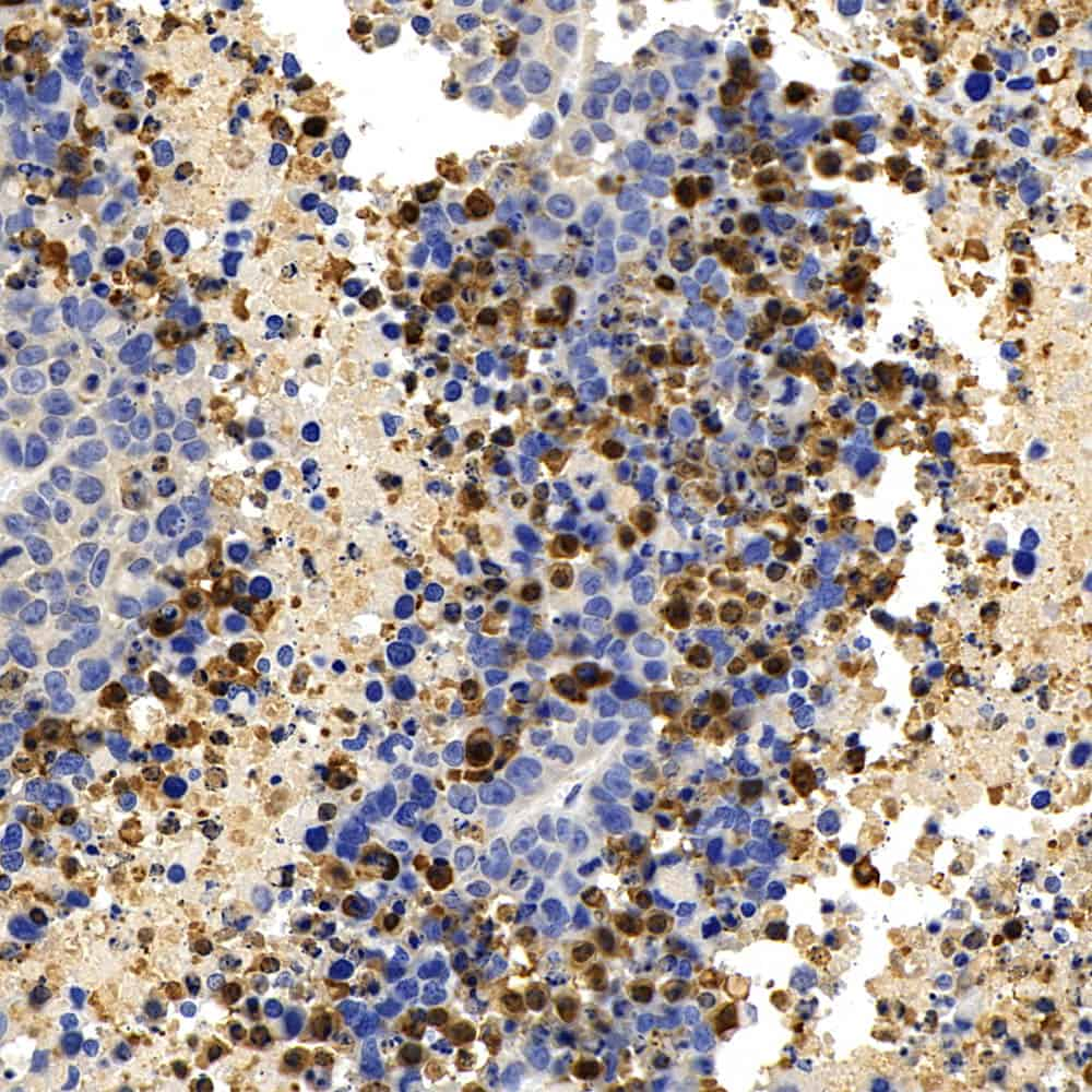 Immunohistochemistry analysis of paraffin-embedded A549 in Mouse lung   using CASP3 Polyclonal Antibody at dilution of 1:400.