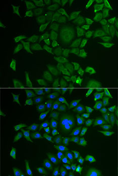 Immunofluorescence analysis of U2OS cells using CCBL1 Polyclonal Antibody Blue: DAPI for nuclear staining.