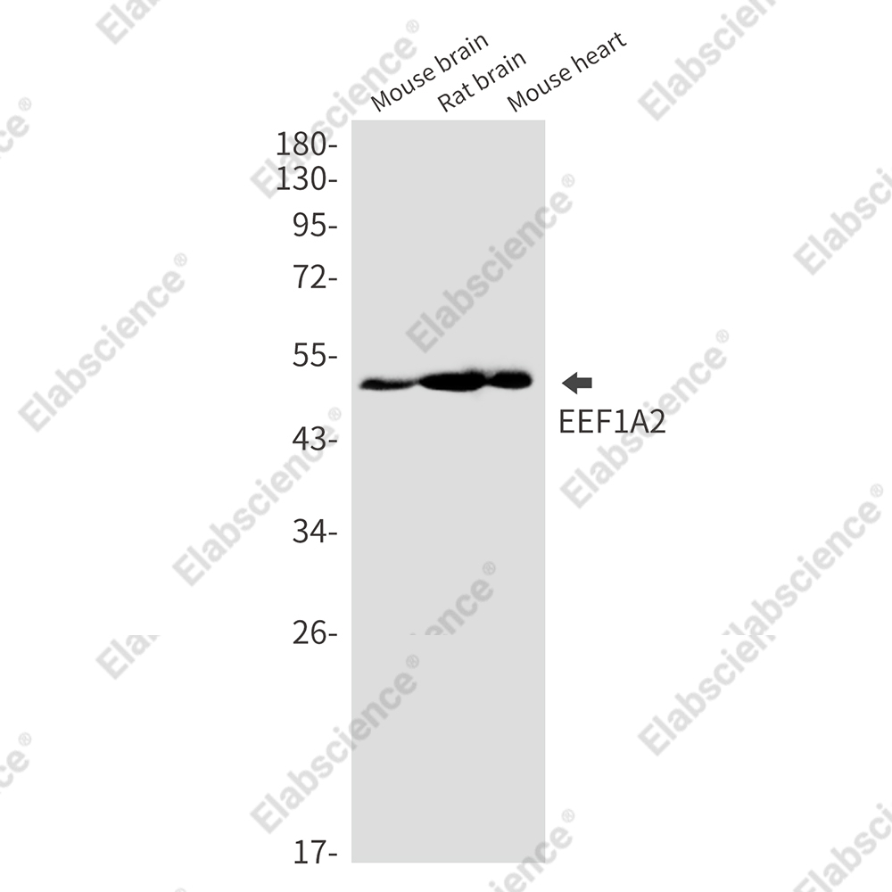 Recombinant Elongation Factor 1A2 Monoclonal Antibody - 1