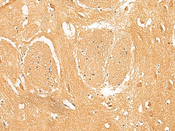 Immunohistochemistry of paraffin-embedded Human brain tissue  using PPP1R1A Polyclonal Antibody at dilution of 1:50(?200)