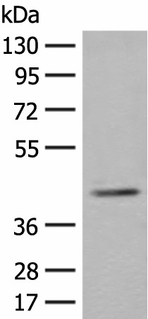 Western blot analysis of K562 cell lysate  using ERGIC3 Polyclonal Antibody at dilution of 1:400