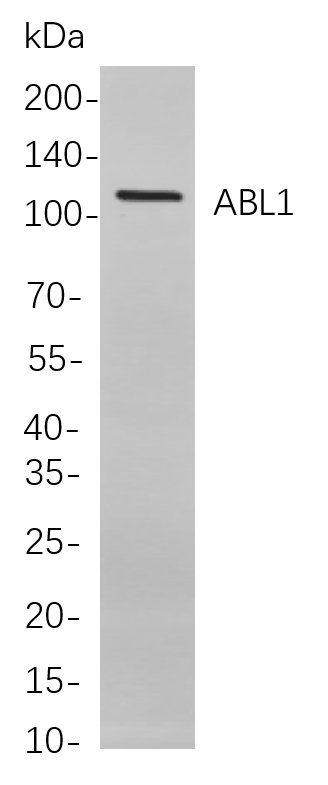 Recombinant ABL1 Monoclonal Antibody-searchlist-1
