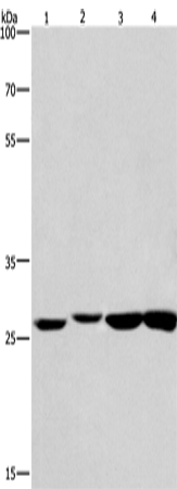 Western Blot analysis of Humna colon cancer and Mouse kidney tissue, Mouse testis and Human fetal brain tissue using KLF7 Polyclonal Antibody at dilution of 1:483.3