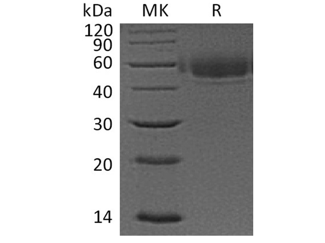 Recombinant Human VSIG4 Protein (His Tag)